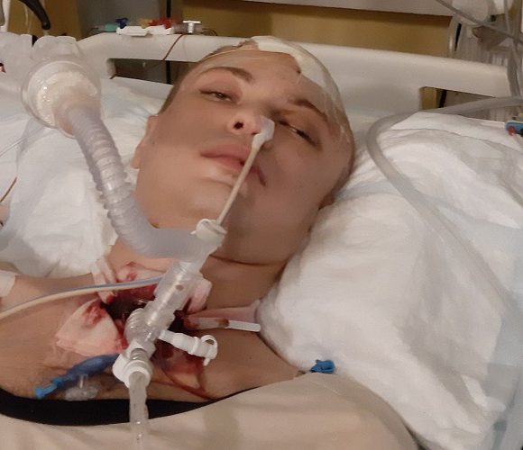 Українця у Польщі вдарили пляшкою по голові, бо заступився за людину. Хлопець у комі