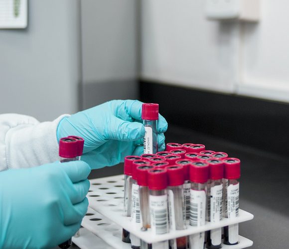Польська фірма виготовила тест для швидкого визначення коронавірусної інфекції: достатньо лише 10 хвилин