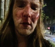 Скандал: в Польщі жорстоко побили українця, а поліція відмовилась його приймати (фото)